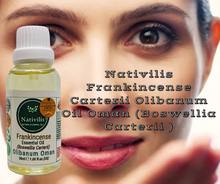 Load image into Gallery viewer, Nativilis Frankincense Carterii Olibanum Oil Oman (Boswellia Carterii ) - natural anti-acne anti-wrinkle improve oral hygiene prevent gum disease antibacterial properties - Copaiba properties 30ml Media 1 of 36