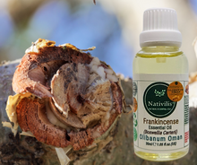 Load image into Gallery viewer, Nativilis Frankincense Carterii Olibanum Oil Oman (Boswellia Carterii ) - natural anti-acne anti-wrinkle improve oral hygiene prevent gum disease antibacterial properties - Copaiba properties 30ml Media 1 of 36