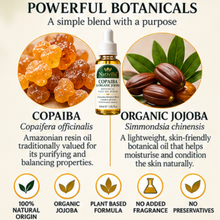 Load image into Gallery viewer, Nativilis Copaiba & Organic Golden Jojoba Botanical Face Oil Serum – 30ml