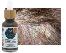 Load image into Gallery viewer, Nativilis URSOLIC ACID enriched with 04 Amazonian Rainforest Bio Oil - ANDIROBA BACURI PRACAXI TUCUMA - Relief skin injuries aesthetic processes peelings laser hair removals Soothing effect Copaiba