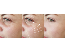 Load image into Gallery viewer, Nativilis URSOLIC ACID enriched with 04 Amazonian Rainforest Bio Oil - ANDIROBA BACURI PRACAXI TUCUMA - Relief skin injuries aesthetic processes peelings laser hair removals Soothing effect Copaiba