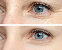 Load image into Gallery viewer, Nativilis URSOLIC ACID enriched with 04 Amazonian Rainforest Bio Oil - ANDIROBA BACURI PRACAXI TUCUMA - Relief skin injuries aesthetic processes peelings laser hair removals Soothing effect Copaiba