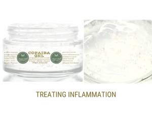 Nativilis Copaiba Gel (Copaifera officinalis) 100% Natural Multipurpose Gel Face Skin Body Moisturizing Anti-aging and Melasma Treating Inflammation Dermatitis and Fungal Infections Relieve Aching Sore Muscles Joint Back Pains Circulation Varicose Veins