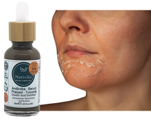 Load image into Gallery viewer, Nativilis URSOLIC ACID enriched with 04 Amazonian Rainforest Bio Oil - ANDIROBA BACURI PRACAXI TUCUMA - Relief skin injuries aesthetic processes peelings laser hair removals Soothing effect Copaiba
